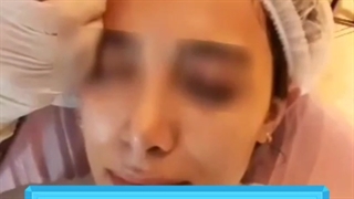 پاکسازی پوست با آکوافیشیال در کلینیک مینیاتور