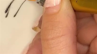 آموزش فیبروز ابرو