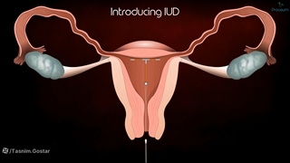 فیلم نحوه برداشتن ای یو دی تسنیم گستر