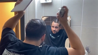 رفع قطعی ریزش مو