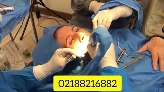 5واحد ایمپلنت در یک روز از نوع کره ای