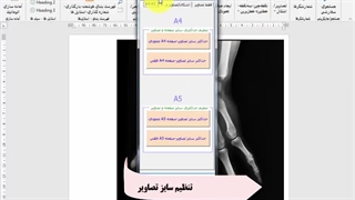 پرینت تصاویر رادیولوژی - حسین لعل جنگی - 09155720733 - ویراستار کلیک Radiologie