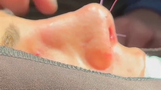 چالش اتاق عمل جراحی بینی