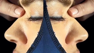 عمل بینی گوشتی