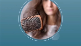 دلایل اصلی ریزش مو