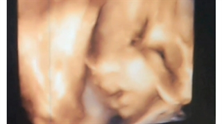 ویدیو کلیپ پسرم ابوالفضل قبل از تولد