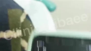 بلفاروپلاستی پلک بالا