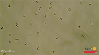 تاریخچه میکروسکوپ