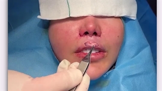 لیفت سانترال لب