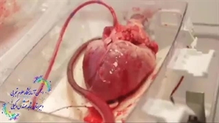 قلب واقعی انسان  (⊙_☉)