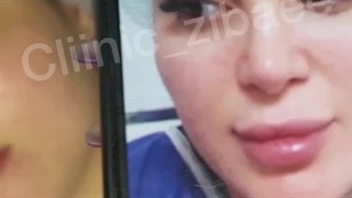 لیفت سانترال لب