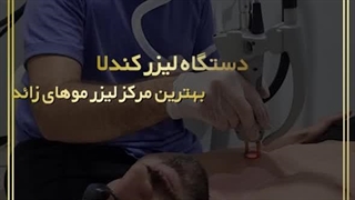 لیزر موهای زائد با لیزر کندلا