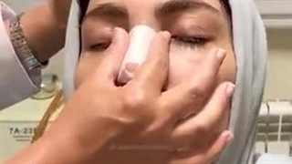 ماساژ دادن بینی