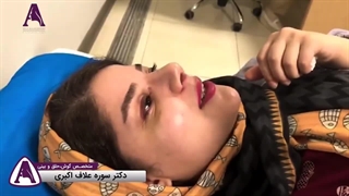 بلافاصله بعد از باز کردن پانسمان بینی