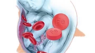 عوارض و کمبود آهن