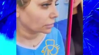 لیفت گونه و گردن