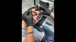 آموزش ریموو تاتو با بروزترین تکنیک توسط نیلوفر کاظمی