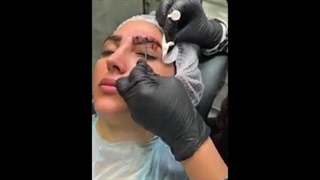 آموزش ریموو تاتو بدون درد به صورت حرفه ای