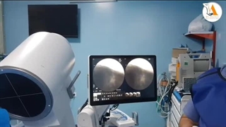 تعریق اندام