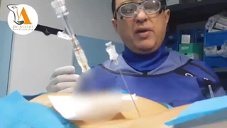 تنگی کانال نخاعی