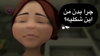 احساسات یه خانم قبل پ بعد از لابیاپلاستی