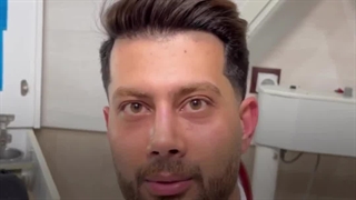 عمل بینی مردانـــــه