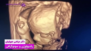 فیلم سونوگرافی جنین