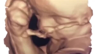 تصویر ســـه بعـــدی از جنیـــن