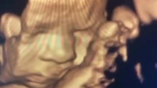 فیلم سونوگرافی سه بعدی جنین