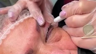 ریموو تاتو خط چشم بدون هیچ گونه عوارض و درد