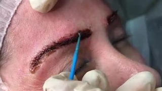 آموزش ریموو تاتو به بهترین صورت با نیلوفر کاظمی