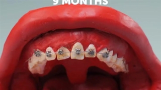 جراحی های پزشکی چشم، گوش، دندانپزشکی، موی سر در یک نگاه با آنی حامی Ani Hami