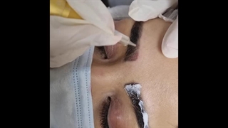 آپ ربمو و مراحل انجام ریمو ابرو