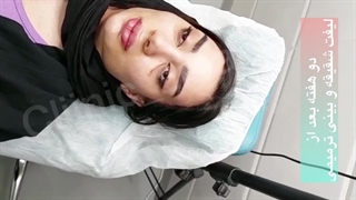 لیفت شقیقو و ایرو و رینوپلاستی ترمیمی