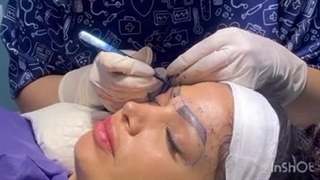 بهترین کاشت ابرو در کرج و تهران