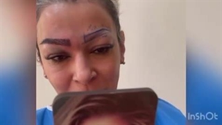 فیلم رضایت کاشت ابرو دائم در حین کاشت ابرو در مرکز کاشت ابرو در کرج و در مرکز کاشت ابرو تهران