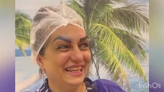 کاشت ابرو طبیعی با تراکم‌بالا در مرکز کاشت ابرو کرج و در مرکز کاشت ابرو تهران و رضایت مراجعه