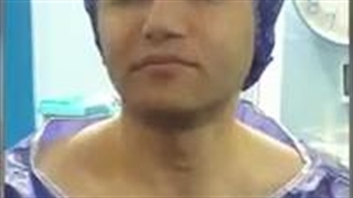 جراحی ترمیمی بینی گوشتی با پره های نامتقارن | دکتر طاهریان