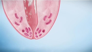 ورم پستان در گاو