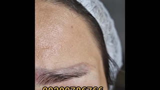 ریموتاتو چند جلسه رشت