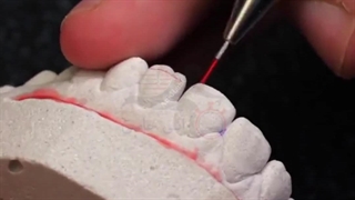 روش ساخت قالب روکش تزئینی دندان مصنوعی با آنی حامی Ani Hami