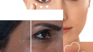 بهترین کرم برای رفع لک و پف و تیرگی زیر چشم 09120132883