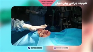 فیلم قبل و بعد عمل بینی