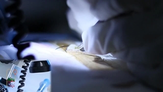 دپارتمان کاشت ابروی کلینیک جردن