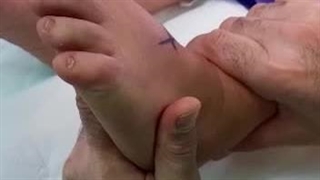 جراحی رباط قوزک پا