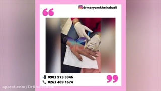پی آر پی (PRP) یا پلاسما درمانی تزریق ژل