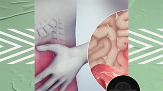 چرا دچار خونریزی مقعدی می شویم؟