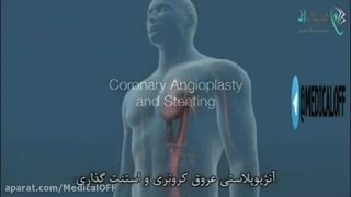 ۷.بیماری کرونر قلب