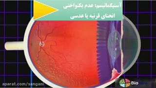 ۱۶.۱۷.۱۹دوربینی،نزدیک بینی،آستیگماتیسم.