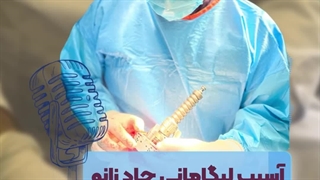 آسیب لیگامانی حاد زانو